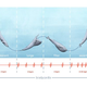 Ilustración para el artículo titulado Los resultados de la primera medición del latido del corazón de una ballena azul son sorprendentes